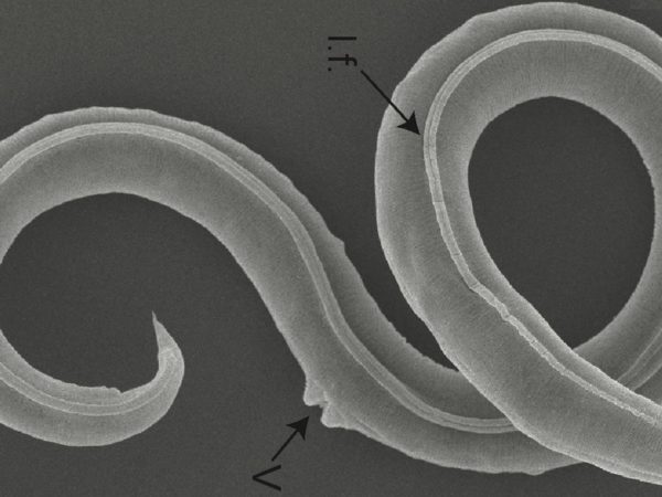 Ancient worms revived after 46,000 years | Science & Tech News