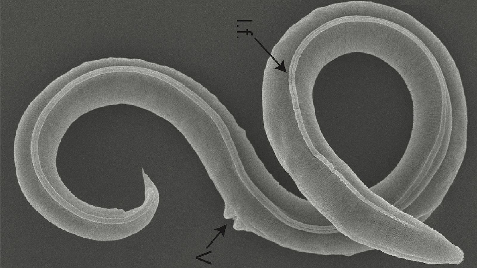 Ancient worms revived after 46,000 years | Science & Tech News