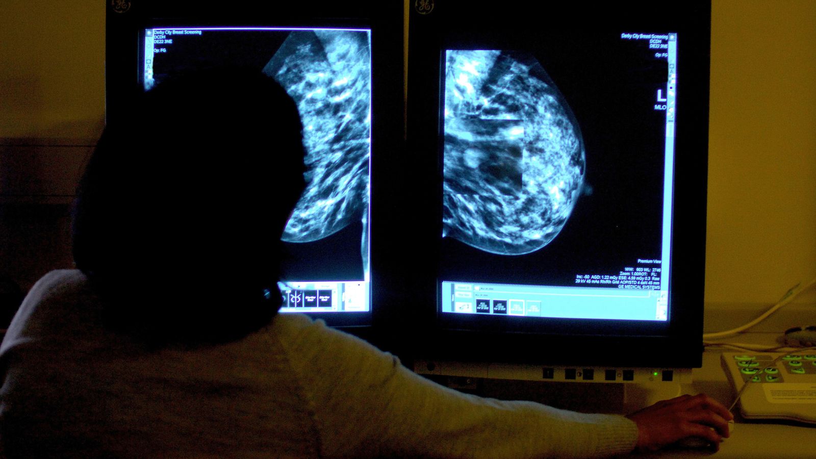 AI tools can ‘safely’ read breast cancer scans, preliminary study suggests | Science & Tech News