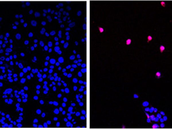 ‘Cancer-killing pill’ that appears to ‘annihilate’ solid tumours is now being tested on humans | Science & Tech News