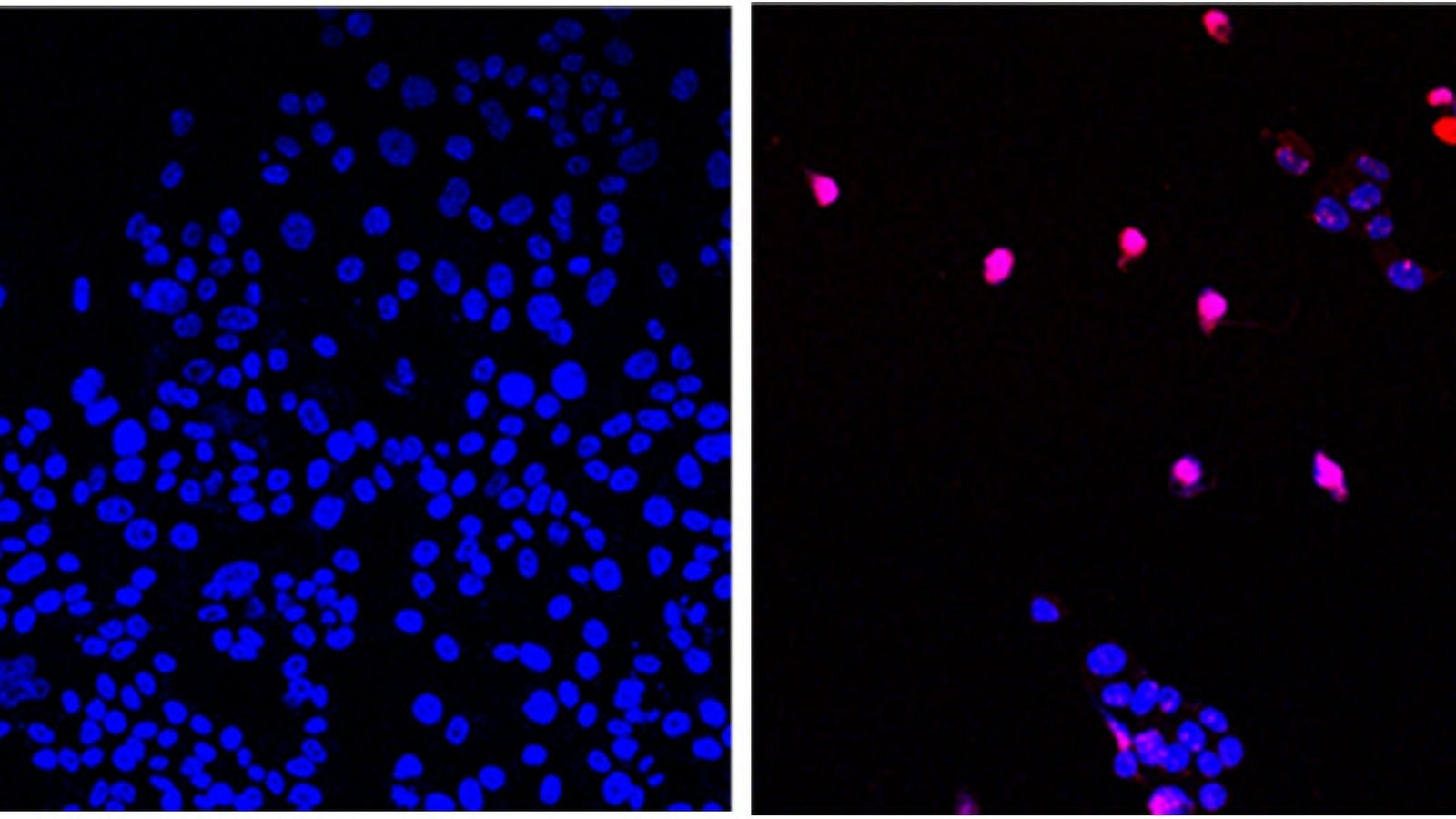 ‘Cancer-killing pill’ that appears to ‘annihilate’ solid tumours is now being tested on humans | Science & Tech News